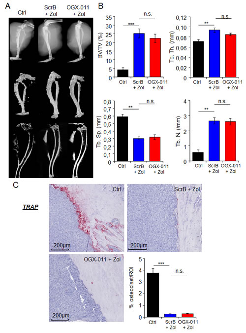 Effect of combination treatment on bone prevention in MNNG/HOS osteosarcoma xenograft model.