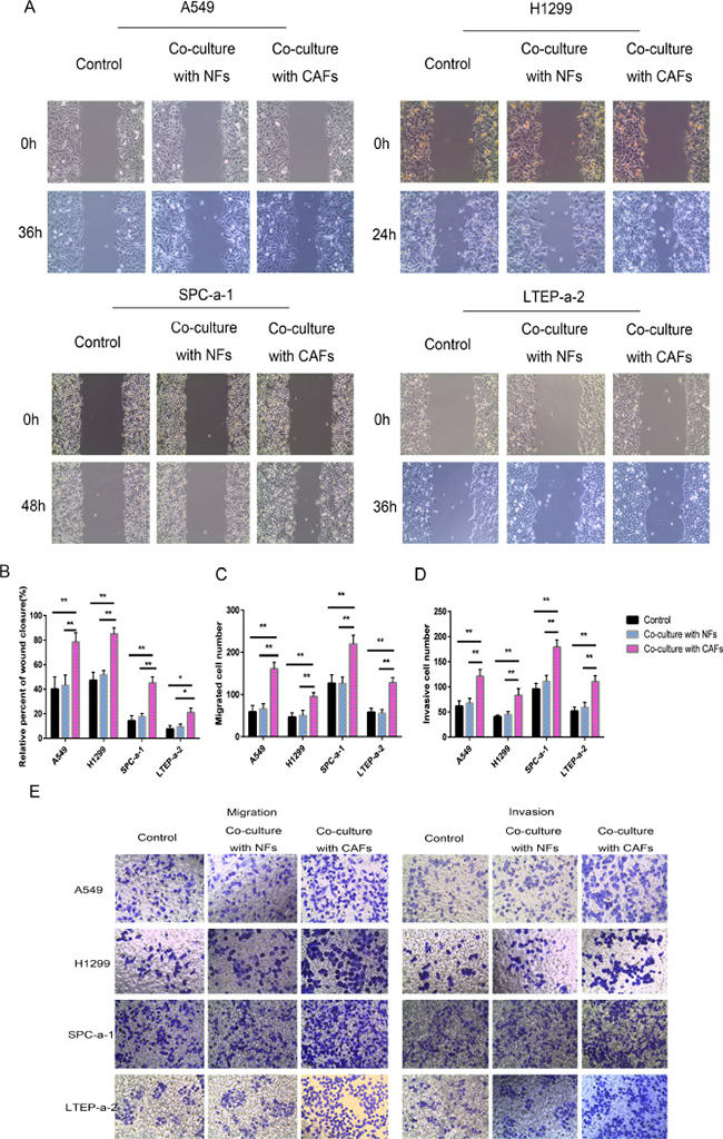 Co-culturing lung cancer cells with CAFs induced cell migration and invasion.