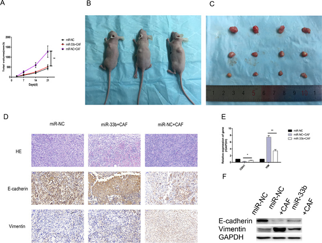 miR-33b inhibited CAF-induced lung cancer cell growth and EMT in vivo.