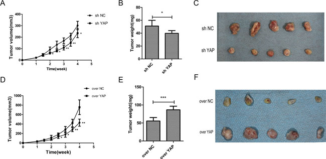 YAP accelerated tumorigenicity of OSCC cells in vivo.