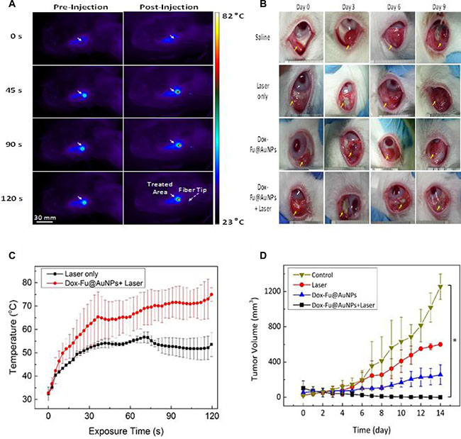 Chemo-photothermal effects of Dox-Fu@AuNPs in rabbit eye tumor model.