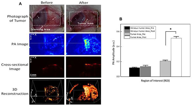 Photoacoustic imaging (PAI) of rabbit eye tumors injected with Dox-Fu@AuNPs.