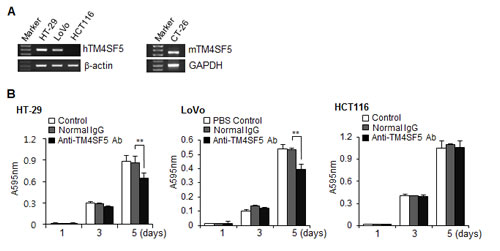 Expression of TM4SF5 in colon cancer cells and the effect of anti-TM4SF5 antibody on the growth of colon cancer cells.