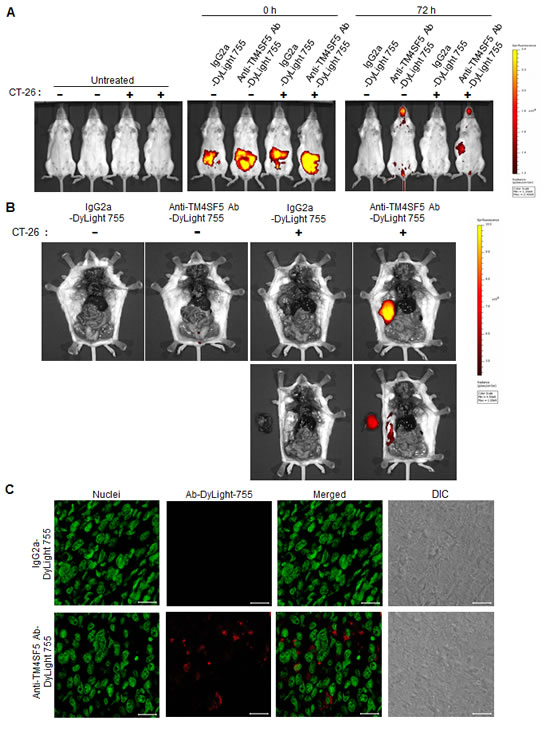 Biodistribution of the anti-TM4SF5 monoclonal antibody in colon tumor tissue.