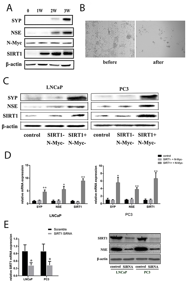 SIRT1 upregulation contributed to NED of Pca cells under ADT conditions.