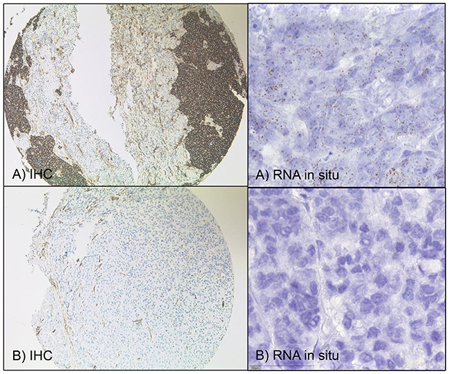 TUBB3 &ndash; immunohistochemistry and RNA-in-situ.