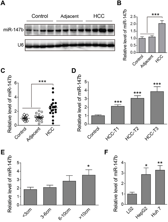 Up-regulation of miR-147b was found in HCC tumor samples and cell lines.