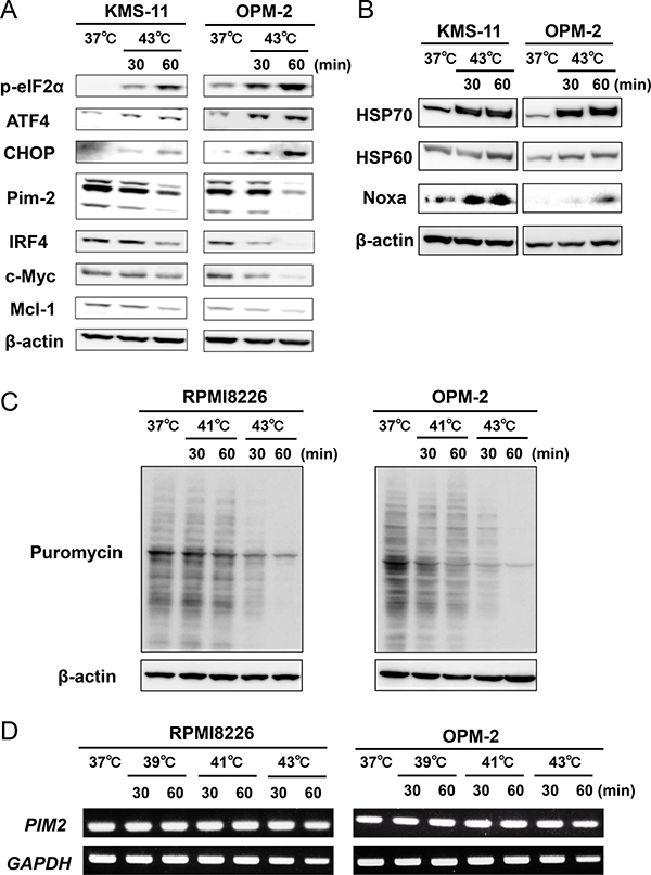 Hyperthermia induces ER stress along with the downregulation of IRF4, Pim-2, c-Myc and Mcl-1 in MM cells.