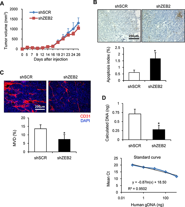 ZEB2 promotes tumor angiogenesis and CTC survival.