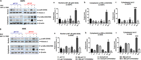 &#x0392;&#x0391;&#x03A5; 11-7082 inhibits the acidic bile-induced NF-