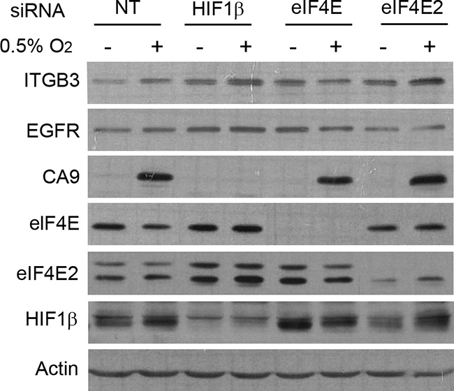 eIF4E is essential for enhanced protein synthesis of ITGB3 under low-oxygen conditions.