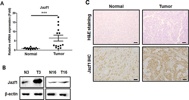 Analysis of Jazf1 expression in human prostate tissue.