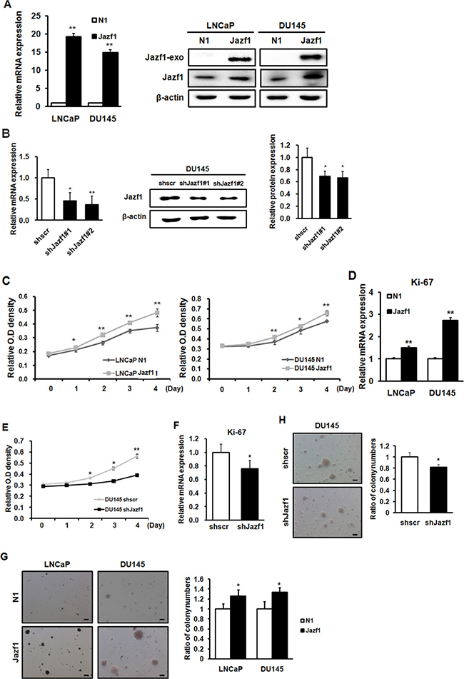 Jazf1 enhances cell proliferation and colony formation ability in human prostate cancer cells.