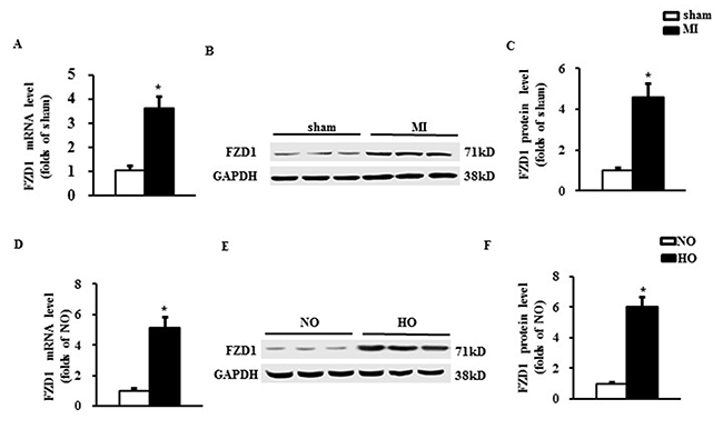 FZD1 was up-regulated by both MI and hypoxic stimuli.