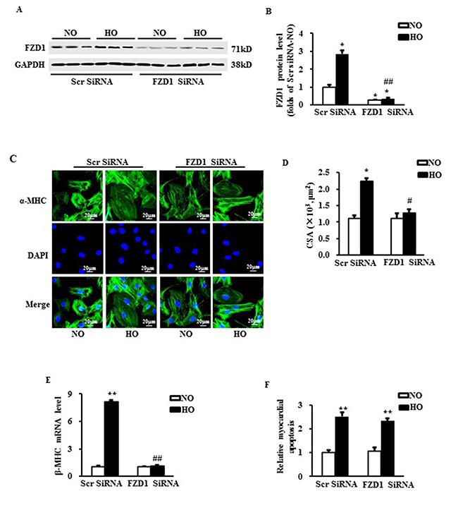 Deficiency of FZD1 alleviated hypoxia-induced myocardial hypertrophy in vitro.