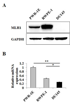 MLH1 expression is downregulated in DU145 PCa cells.