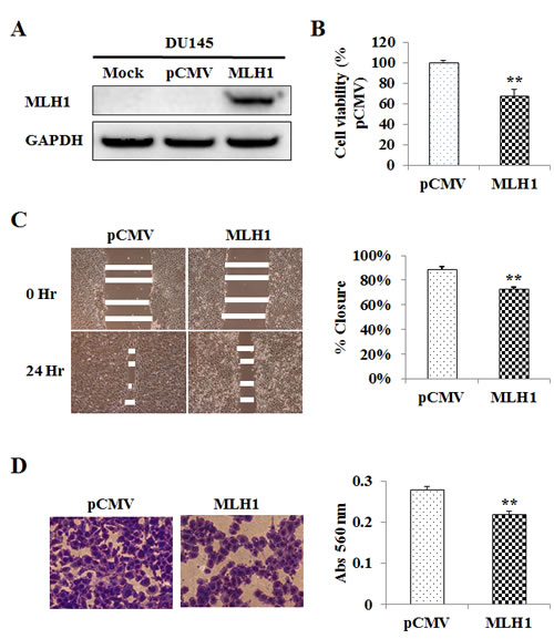 Re-expression and tumor suppressive effect of MLH1 on DU145 cells.