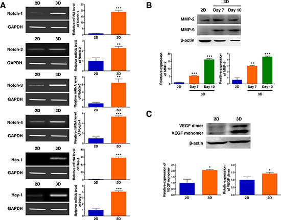 3D microenvironment in AmCA hydrogels enhances the expression of tumor aggressiveness factors in 3D lymphoma spheroids compared to their 2D cultures.