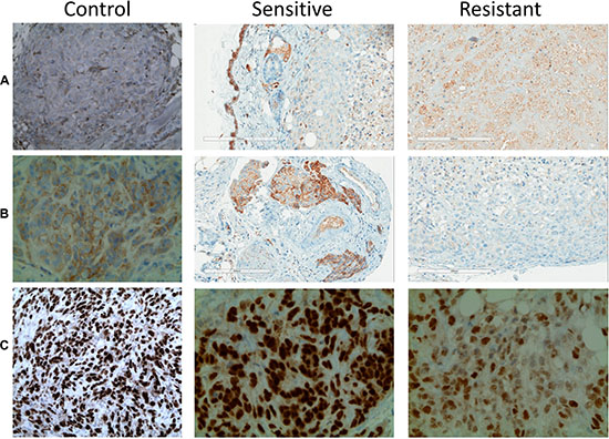 Immunostaining patterns of sunitinib sensitive and resistant tumors.