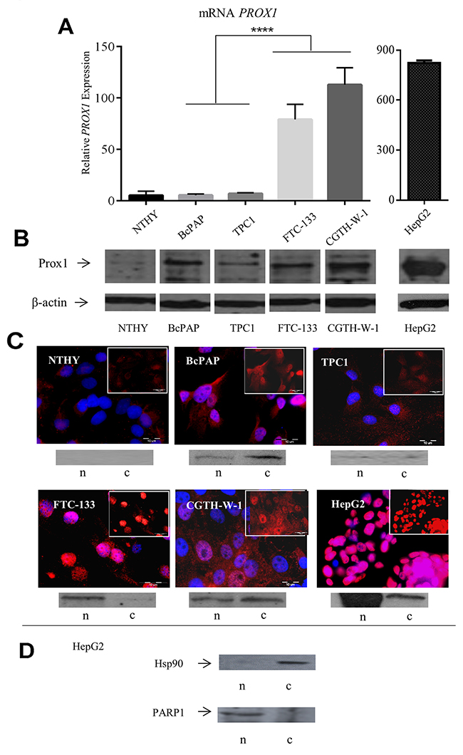 Expression of PROX1 in thyroid carcinoma cell lines.