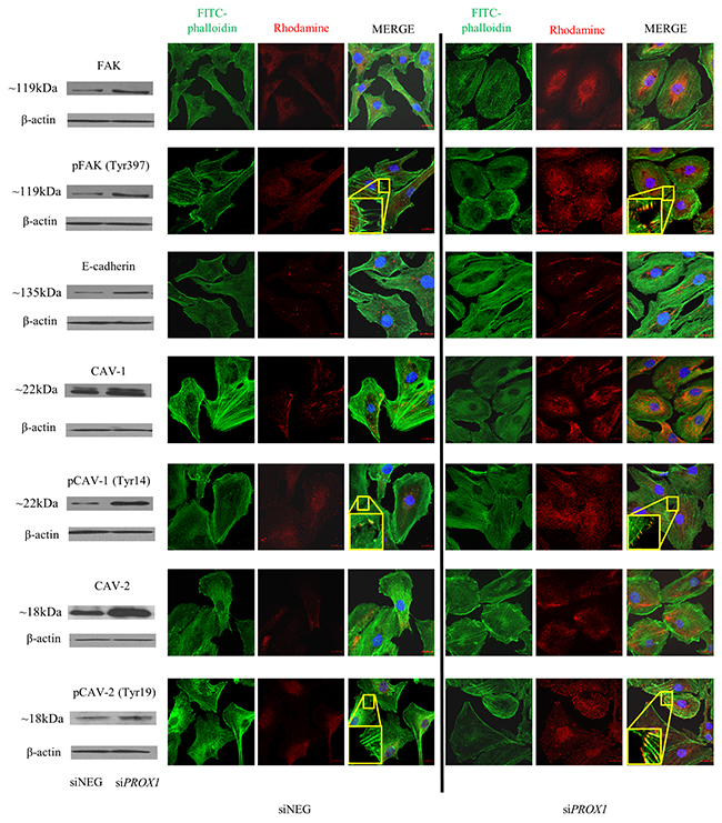 Immunofluorescent staining of FAK/pFAK CAV-1/pCAV-1, CAV-2/pCAV-2 and E-cadherin in FTC-133 cells depleted of Prox1.