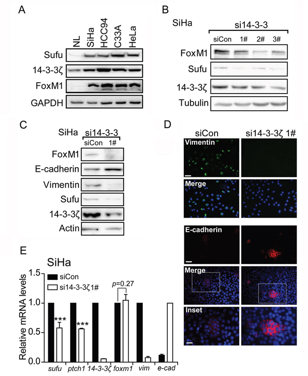 14-3-3&#x03B6; regulates the EMT markers through mediating FoxM1-Sufu/Hedgehog cascade.