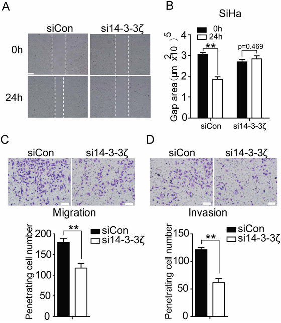 Inhibition of 14-3-3&#x03B6; decreases migration and invasion of SiHa cell.