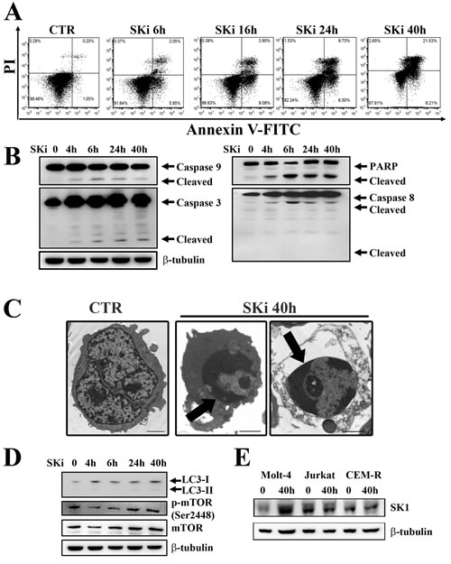 SKi triggers apoptosis in Molt-4 cell line.