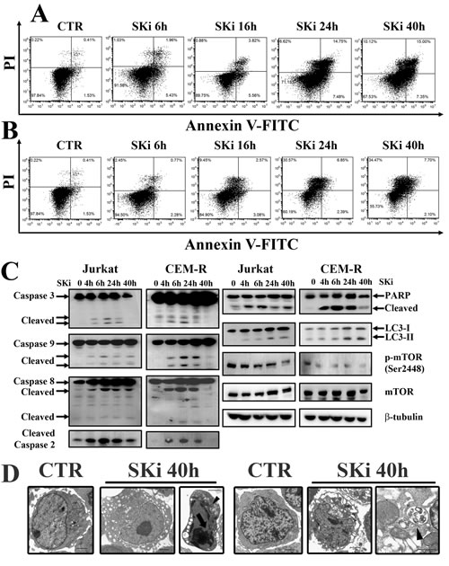 SKi treatment induces apoptosis and autophagy in Jurkat and CEM-R cells.
