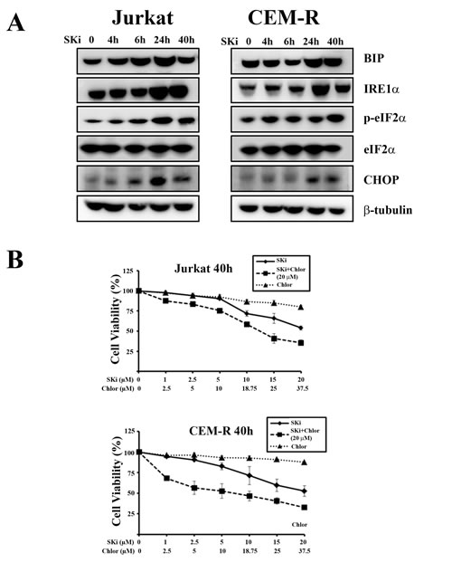 SKi induces autophagy as a consequence of ER stress/UPR activation in Jurkat and CEM-R cells.