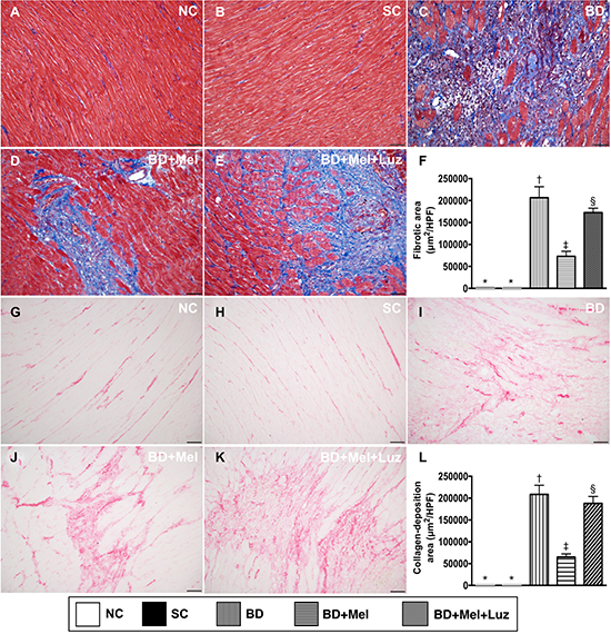 Microscopic findings of fibrotic and condensed collagen-deposition areas in LV myocardium by day 5 after BD-derived tissue implantation.
