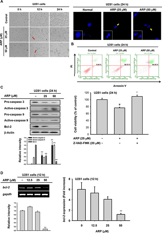 Pro-apoptotic effect of aripiprazole (ARP) in U251 cells.