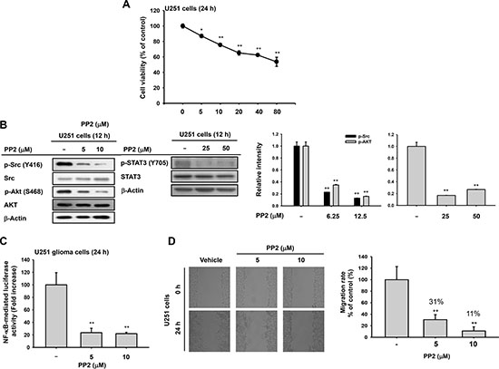 Antitumor effects of Src inhibitor PP2 on U251 glioma cells.