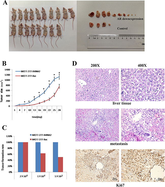 AR knockdown promoted tumorigenic capacity and metastasis in mice.