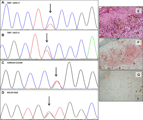 Somatic and germline mutations and variants in one representative case.