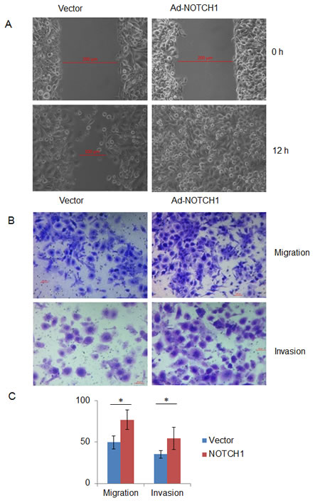 Overexpression of NOTCH1 increases the migration and invasion abilities of SACC-83 cells.