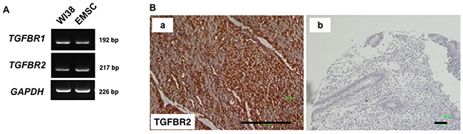 TGFBR2 expression in normal tissues.