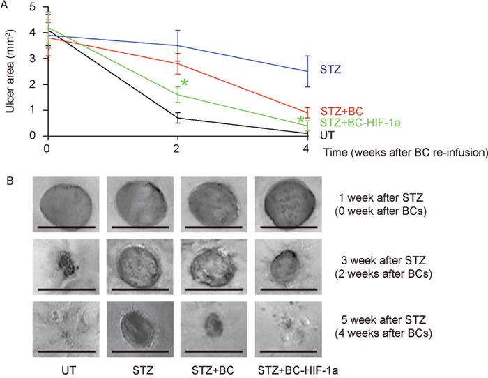 Expression of HIF-1a in re-infused BCs improves diabetic wound closure.