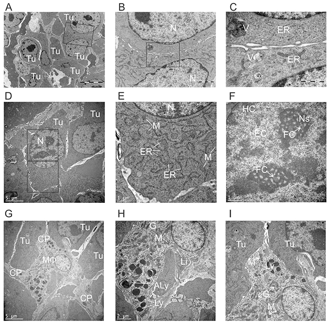 Ultrastructural appearance of non-treated tumors.