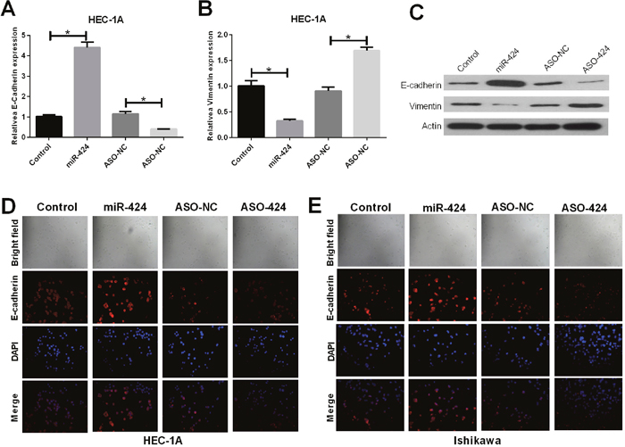 Influence of miR-424 on EMT markers vimentin and E-cadherin.