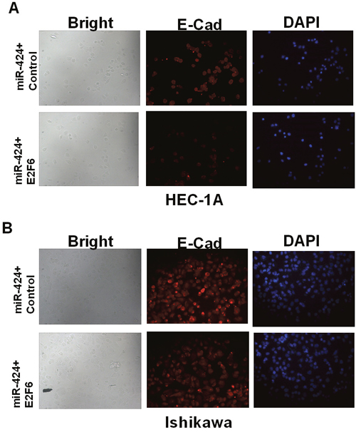 E2F6 reversed the promoting effect of miR-424-mediated EC cell adhesion.