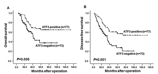 Kaplan-Meier curves depicting overall survival (OS, A) and the disease-free survival (DFS, B) according to expression patterns of ATF3 in ESCC samples.