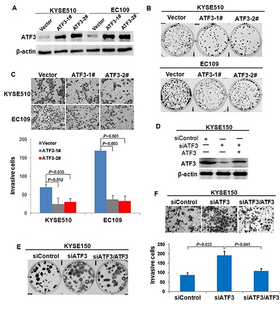 Effect of ATF3 expression on cell growth and invasion.
