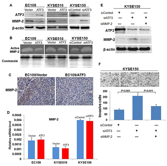 Expression and activity of MMP-2 in the ATF3 altered-expression ESCC cells.