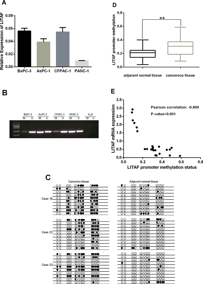 Transcription of LITAF is regulated by promoter methylation.