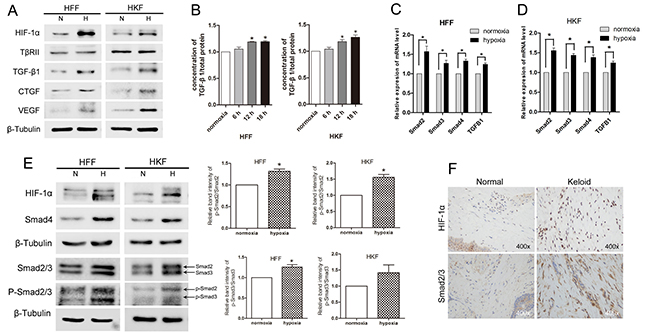 Hypoxia promoted TGF-&#x03B2;/Smad signaling in HFFs and HKFs.