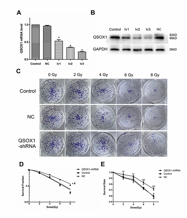 Knockdown of QSOX1 and its effect on radiosensitivity of NPC cells.