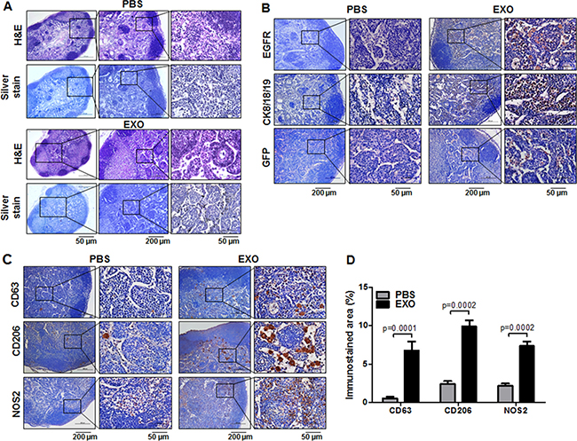 Histological analysis of axillary LN metastasis promoted by cancer cell&#x2013;derived exosomes in TNBC models.