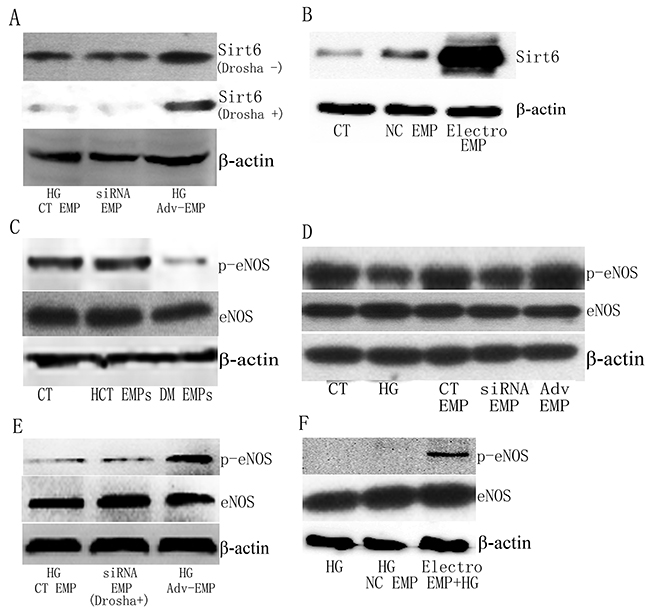 Sirt6 protein and phosphorylation of eNOS is different in HUVECs following exposure to EMPs.