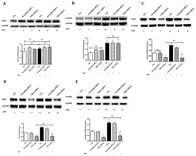 NBA1-siRNA decreased NBA1, SPK1, and P-SPK1 protein expressions, but no effect on AKT2 and P-AKT2 protein expression.